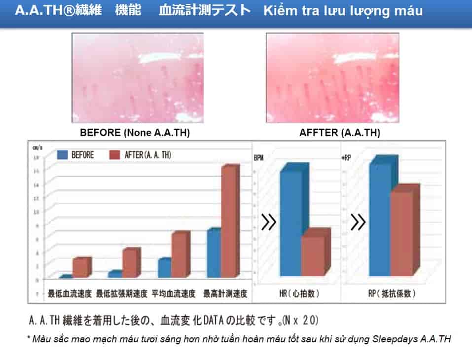 Kiem-tra-luu-luong-mau-tatnanosleepdays
